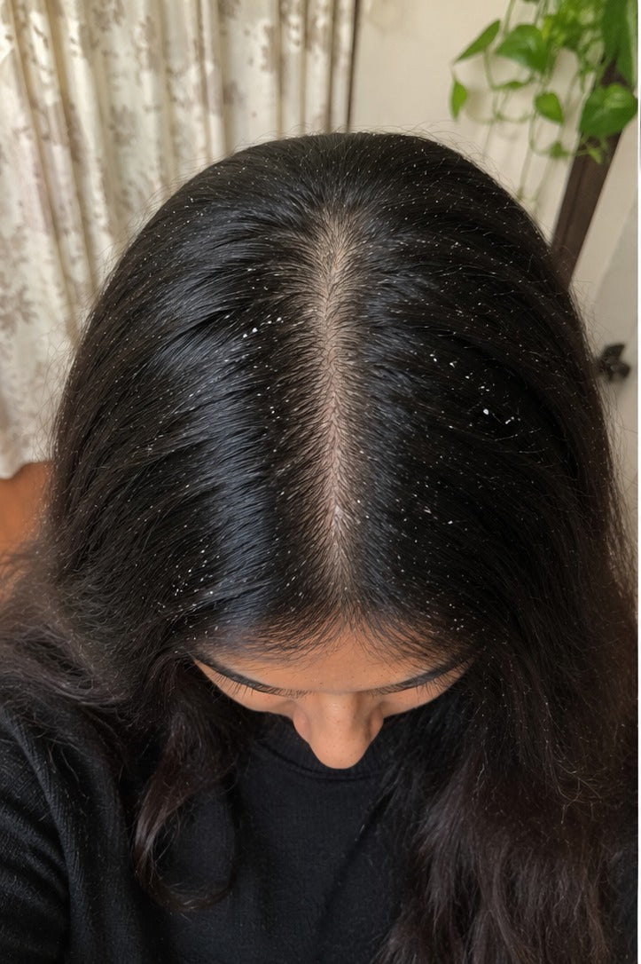  before using the product